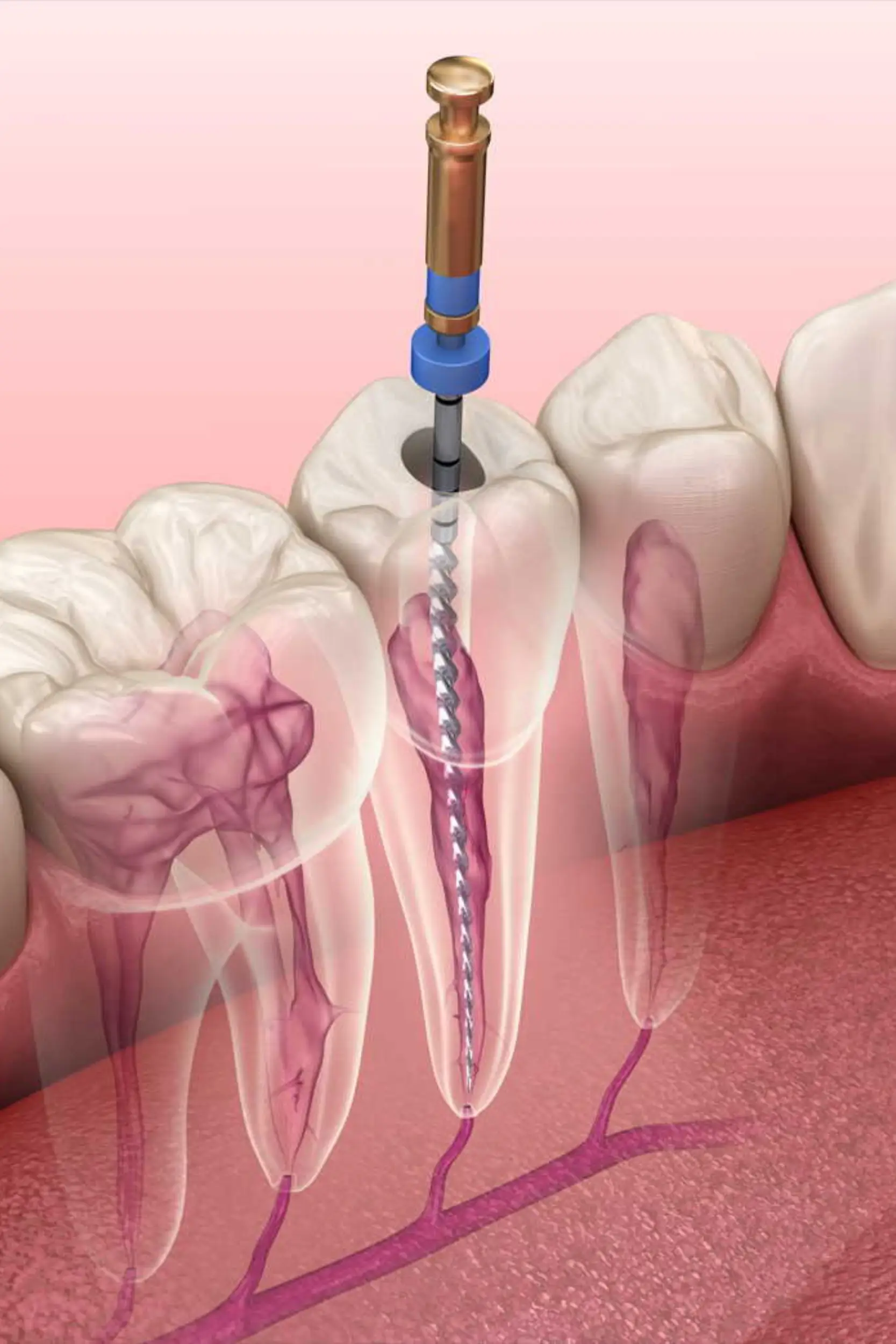 Endodonzia
